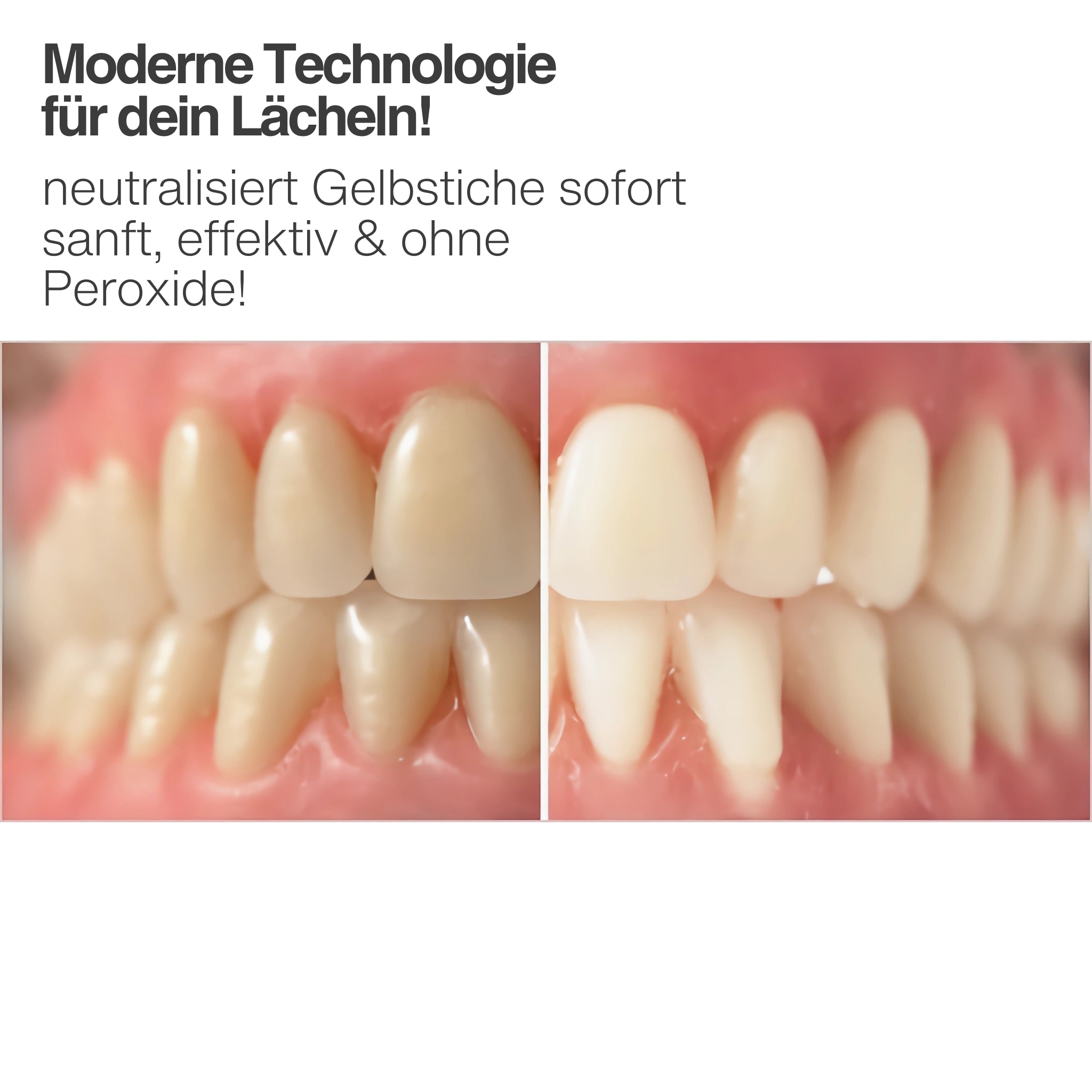 Sarmocare Schallzahnbürste & SmileKit Farbkorrektur-Zahnpasta